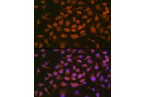 Immunofluorescence analysis of HeLa cells using GRK2 Rabbit mAb (ABIN7265504) at dilution of 1:100 (40x lens). (GRK2 抗体)