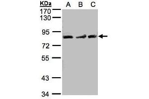 Image no. 1 for anti-MutL Homolog 1 (MLH1) (AA 373-735) antibody (ABIN467426) (MLH1 抗体  (AA 373-735))
