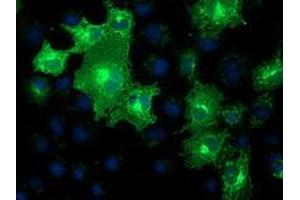 Immunofluorescence (IF) image for anti-Methylmalonic Aciduria (Cobalamin Deficiency) CblB Type (MMAB) antibody (ABIN1499509) (MMAB 抗体)