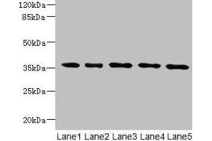 Western blot All lanes: OXNAD1 antibody at 4 μg/mL Lane 1: Mouse large intestine tissue Lane 2: Mouse lung tissue Lane 3: K562 whole cell lysate Lane 4: U251 whole cell lysate Lane 5: A549 whole cell lysate Secondary Goat polyclonal to rabbit IgG at 1/10000 dilution Predicted band size: 35 kDa Observed band size: 35 kDa (OXNAD1 抗体  (AA 18-312))