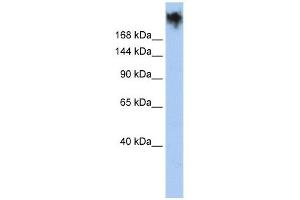 PKDREJ antibody used at 1 ug/ml to detect target protein. (PKDREJ 抗体  (Middle Region))