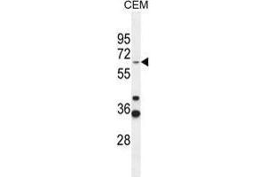 ZNF667 Antibody (Center) western blot analysis in CEM cell line lysates (35 µg/lane). (ZNF667 抗体  (Middle Region))