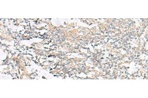 Immunohistochemistry of paraffin-embedded Human tonsil tissue using HELT Polyclonal Antibody at dilution of 1:40(x200) (HELT 抗体)