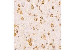 Immunohistochemistry analysis of paraffin-embedded human placenta using,CLIC6 (ABIN7073478) at dilution of 1: 600 (CLIC6 抗体)