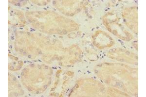 Immunohistochemistry of paraffin-embedded human kidney tissue using ABIN7171008 at dilution of 1:100