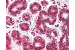 Anti-NUR77 antibody IHC of human breast. (NR4A1 抗体  (AA 401-414))
