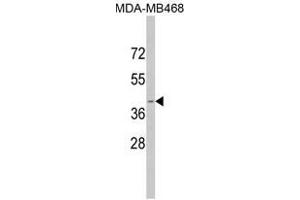 Image no. 1 for anti-Apolipoprotein L, 1 (APOL1) (BH3 Domain) antibody (ABIN452749) (APOL1 抗体  (BH3 Domain))