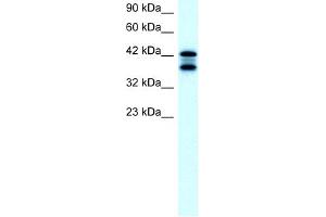 WB Suggested Anti-ACAT2 Antibody Titration:  2. (ACAT2 抗体  (Middle Region))