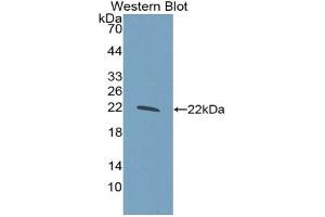 Western blot analysis of the recombinant protein. (GCKR 抗体  (AA 320-499))