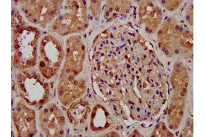 IHC image of ABIN7163794 diluted at 1:400 and staining in paraffin-embedded human kidney tissue performed on a Leica BondTM system. (PCGF1 抗体  (AA 113-187))