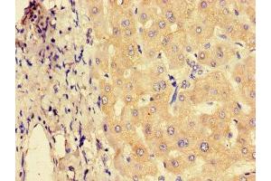 Immunohistochemistry of paraffin-embedded human liver tissue using ABIN7151230 at dilution of 1:100 (SYVN1 抗体  (AA 338-487))