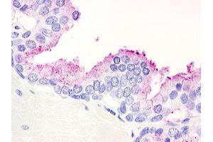 Anti-GPR21 antibody IHC of human prostate.