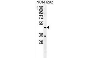 Western Blotting (WB) image for anti-Tripartite Motif Containing 72 (TRIM72) antibody (ABIN2996476)