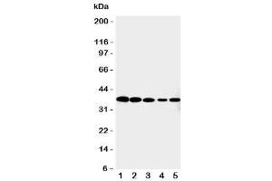 Western blot testing of Cdk7 antibody and Lane 1:  HeLa (CDK7 抗体  (C-Term))