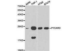 Western Blotting (WB) image for anti-Steroid Sulfatase (STS) antibody (ABIN1874484) (STS 抗体)