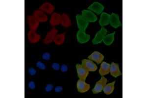 ABIN6262581 and ABIN6276765 staining Hela cells(30 min of UV treatment) by IF/ICC.