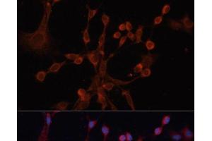 Immunofluorescence analysis of NIH/3T3 cells using GNA14 Polyclonal Antibody at dilution of 1:100. (GNa14 抗体)