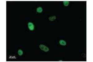 Immunostaining analysis in HeLa cells. (KIF22 抗体)