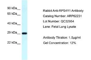 Western Blotting (WB) image for anti-Ribosomal Protein S4, Y-Linked 1 (RPS4Y1) (C-Term) antibody (ABIN2789074)