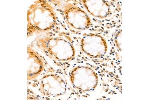 Immunohistochemistry analysis of paraffin-embedded human colon using,SATB2 (ABIN7075514) at dilution of 1: 1500 (SATB2 抗体)