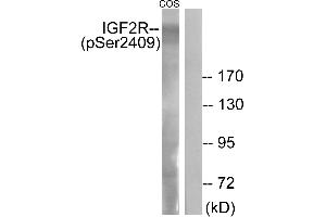 Western blot analysis of extracts from COS-7 cells, treated with UV (15 mins), using IGF2R (Phospho-Ser2409) antibody. (IGF2R 抗体  (pSer2409))