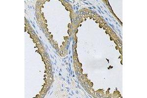 Immunohistochemical analysis of SRP19 staining in human prostate formalin fixed paraffin embedded tissue section. (SRP19 抗体)