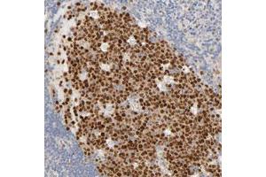Immunohistochemical staining (Formalin-fixed paraffin-embedded sections) of human lymph node with MEF2B polyclonal antibody  shows strong nuclear expression in germinal center cells. (MEF2B 抗体)