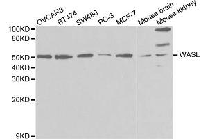 Western blot analysis of extracts of various cell lines, using WASL antibody (ABIN5971401) at 1/1000 dilution. (Neural Wiskott-Aldrich syndrome protein (WASL) 抗体)