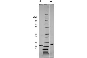 SDS-PAGE of Human Rat Fibroblast Growth Factor basic Recombinant Protein SDS-PAGE of Rat Fibroblast Growth Factor basic Recombinant Protein. (FGF2 蛋白)