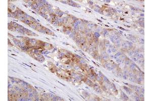 Image no. 5 for anti-Integrin alpha FG-GAP Repeat Containing 3 (ITFG3) antibody (ABIN1498916)