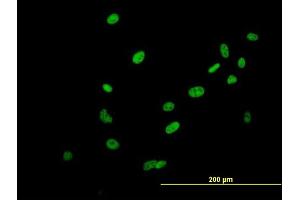 Immunofluorescence of purified MaxPab antibody to SAFB2 on HeLa cell. (SAFB2 抗体  (AA 1-528))