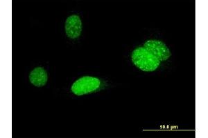 Immunofluorescence of monoclonal antibody to AURKB on HeLa cell. (Aurora Kinase B 抗体  (AA 1-90))