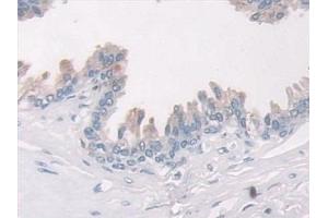 Immunohistochemistry (IHC) image for anti-Plasminogen Activator Inhibitor 1 (SERPINE1) antibody (ABIN7427915)