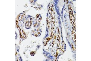 Immunohistochemistry of paraffin-embedded human placenta using APOE Rabbit pAb (ABIN6133561, ABIN6137017, ABIN6137019 and ABIN6213793) at dilution of 1:50 (40x lens).
