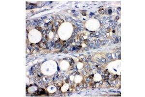 IHC analysis of Stathmin 1 using anti-Stathmin 1 antibody (ABIN3043301). (Stathmin 1 抗体  (N-Term))