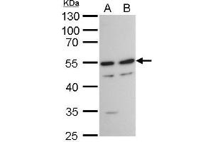 WB Image TAF7 antibody detects TAF7 protein by western blot analysis. (TAF7 抗体  (Center))