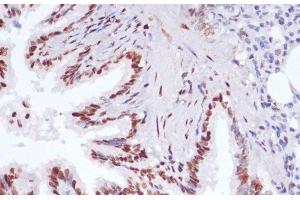 Immunohistochemistry (Paraffin-embedded Sections) (IHC (p)) image for anti-Histone 3 (H3) (acLys14), (acLys18), (acLys23), (acLys27), (acLys9) antibody (ABIN7259751)