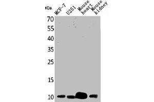 Western Blot analysis of MCF7 U251 mouse liver mouse kidney cells using ACBP Polyclonal Antibody (Diazepam Binding Inhibitor 抗体  (C-Term))