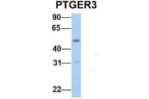 Western Blotting (WB) image for anti-Prostaglandin E Receptor 3 (Subtype EP3) (PTGER3) (C-Term) antibody (ABIN2778264)
