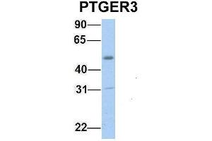 Host:  Rabbit  Target Name:  PTGER3  Sample Type:  Human Fetal Muscle  Antibody Dilution:  1. (PTGER3 抗体  (C-Term))