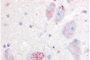 Human Basal Nucleus of Meynert (formalin-fixed, paraffin-embedded) stained with GPR20 antibody ABIN213332 at 20 ug/ml followed by biotinylated goat anti-rabbit IgG secondary antibody ABIN481713, alkaline phosphatase-streptavidin and chromogen. (GPR20 抗体  (Cytoplasmic Domain))