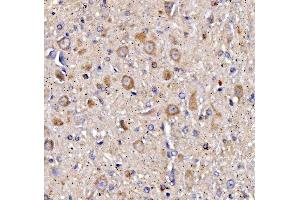 IHC analysis of CHRM1 using anti-CHRM1 antibody (ABIN7602749).
