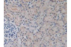 Immunohistochemistry (IHC) image for anti-Bone Morphogenetic Protein 15 (BMP15) (AA 274-390) antibody (ABIN7441940)