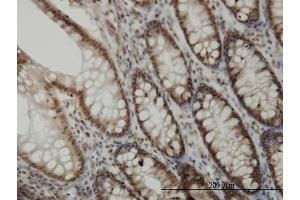 Immunoperoxidase of monoclonal antibody to CDK6 on formalin-fixed paraffin-embedded human colon. (CDK6 抗体  (AA 3-99))