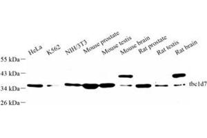 Western blot analysis of tbc1d7 (ABIN7075849) at dilution of 1: 500 (TBC1D7 抗体)
