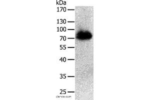 Western blot analysis of Human liver cancer tissue, using PRMT7 Polyclonal Antibody at dilution of 1:500 (PRMT7 抗体)