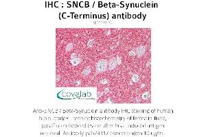 Image no. 1 for anti-Synuclein, beta (SNCB) antibody (ABIN1739479) (beta Synuclein 抗体)