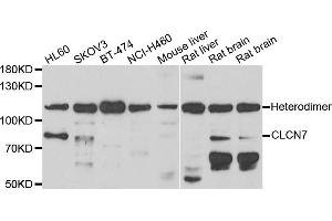 Western blot analysis of extracts of various cell lines, using CLCN7 antibody. (CLCN7 抗体)