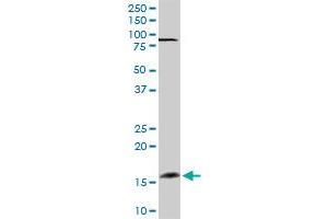 FGF1 MaxPab rabbit polyclonal antibody. (FGF1 抗体  (AA 1-155))