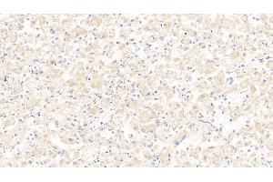 Detection of SCGB2A2 in Human Mammary gland Tissue using Polyclonal Antibody to Secretoglobin Family 2A, Member 2 (SCGB2A2) (Mammaglobin A 抗体  (AA 19-93))